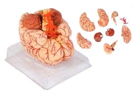 Cérebro com Artérias 9 partes